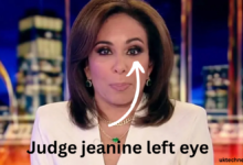 Judge jeanine left eye